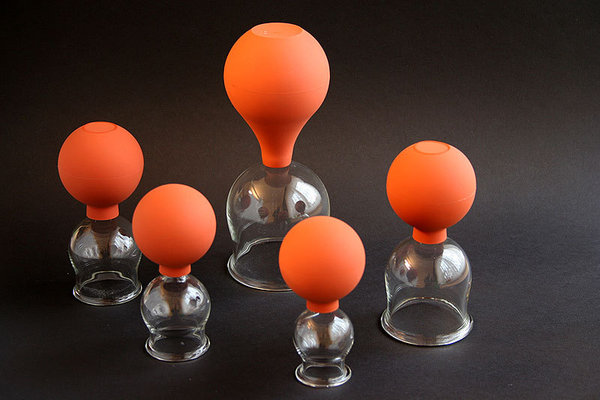 Schröpfglas mit Saugball, 3,5 cm Durchmesser